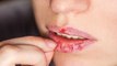 होंठ फटने के कारण। होंठ फटने से कैसे बचाएं । Chapped Lips Causes। Boldsky