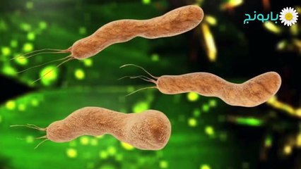 عامر حلباوي- جرثومة المعدة الحلزونية