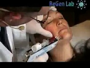 Regen Lag au Palais des Congrès