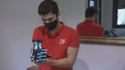 Hand Solo, el joven que lucha pieza a pieza contra la "dif-capacidad"