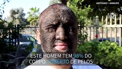 O verdadeiro lobisomem existe e vive nos EUA