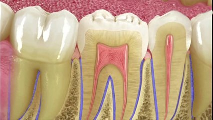 bd-evite-perder-piezas-dentales-030321