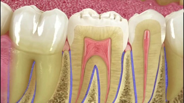 bd-evite-perder-piezas-dentales-030321