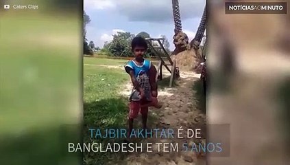 Bizarro! Mão de criança pesa mais de 5kg!