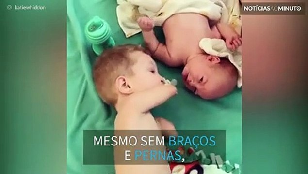 Mesmo sem braços e pernas, garoto cuida do irmão mais novo