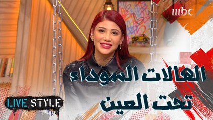 ما هو العلاج الأكثر فعالية للهالات السوداء؟