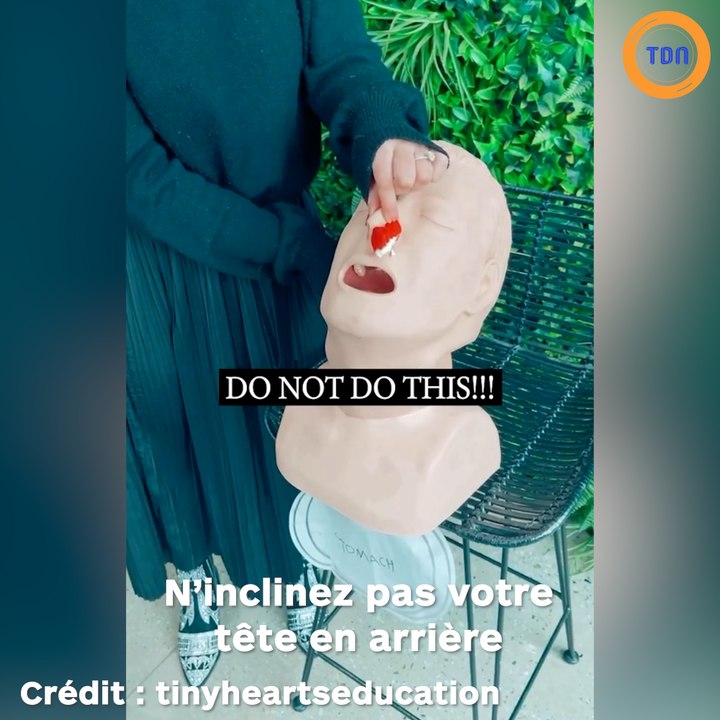 Voici pourquoi vous ne devait pas incliner la tête en arrière si vous saignez du nez !