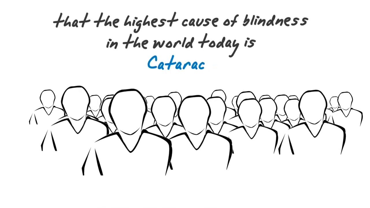 Cataract information