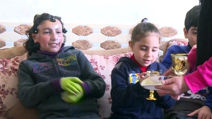أقنعة بلاستيكية ثلاثية الأبعاد تمنح الأمل لضحايا حروق الوجه في غزة