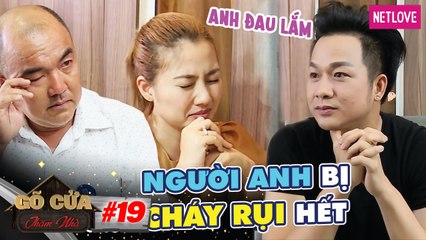 Gõ Cửa Thăm Nhà - Tập 19: Bị Lửa Thiêu Cháy Người, Quách Tuấn Du Đau Đớn Bật Khóc Chạy Chữa