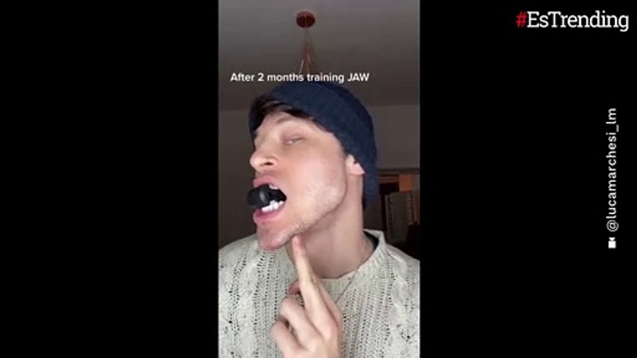 La impresionante transformación del rostro de un modelo italiano tras meses de entrenamiento de mandíbula