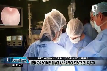 INSN-Breña: extraen con éxito tumor a niña de tres años