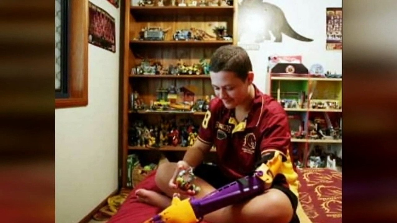 Student developing AI-assisted robotic prosthetic