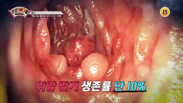위암 4기를 극복할 수 있었던 기적의 비법은?_명심보감 29회 예고 TV CHOSUN 210308 방송