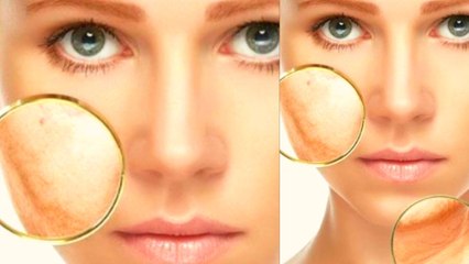 25 में ही झुर्रियां दिखा रही 40 का तो इस चीज का करें इस्तेमाल, यूं बनाकर लगाएं पैक । Boldsky