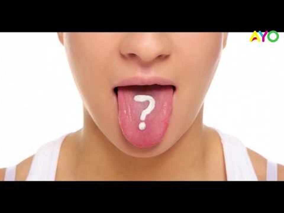 Bahan Alami Ini Bisa Jadi Obat Ampuh Usir Sariawan Lho