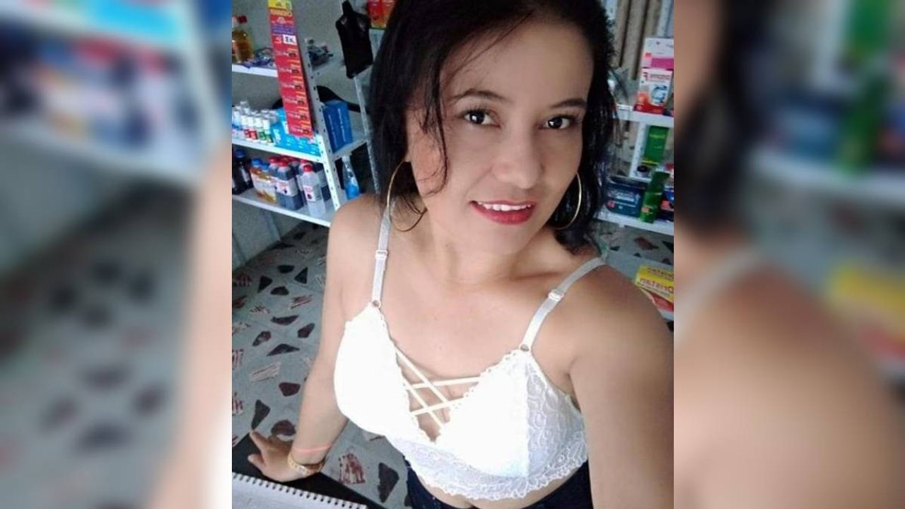 Mujer ha sido sometida a 12 cirugías tras ser atacada con ácido por su expareja