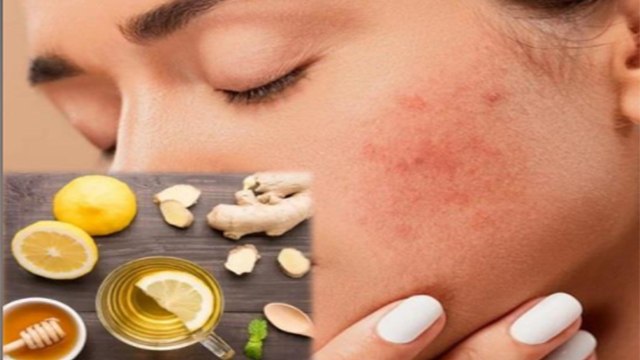 Skin Care Tips: परेशानी में डाल सकते हैं ये घरेलू नुस्खे, सही जानकारी के साथ करें ट्राई । Boldsky