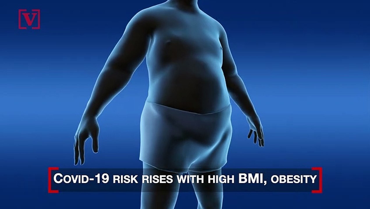Obesity and High BMI are Covid-19 Risk Factors: CDC