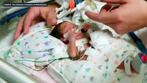 Úteros artificiales: ¿el futuro para los bebés prematuros?