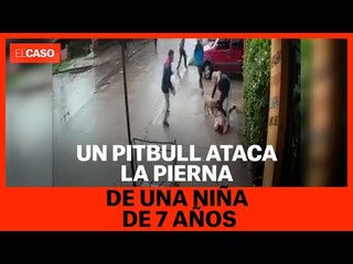 Un pitbull ataca la pierna de una niña de 7 años