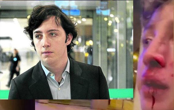 Las imágenes de la paliza que mandó al hospital al Pequeño Nicolás