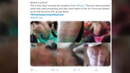 미얀마 시민들, SNS에 쇠사슬로 맞은 사진 공개 / YTN