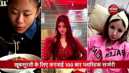 वीडियो : सुंदर दिखने के लिए करवाई 100 सर्जरी, लेकिन हो गई ऐसी हालत