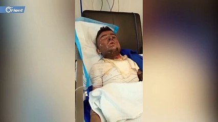 تعرض شاب سوري في لبنان لحروق خطيرة نتيجة قيام عدد من الشبان بإلقاء مادة حارقة عليه