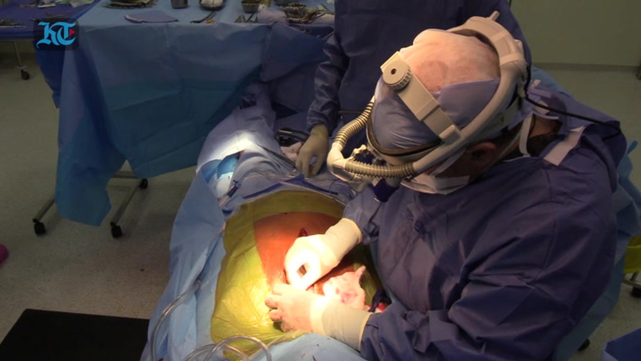 Dubai doctor saves Pakistani expat with landmark surgery