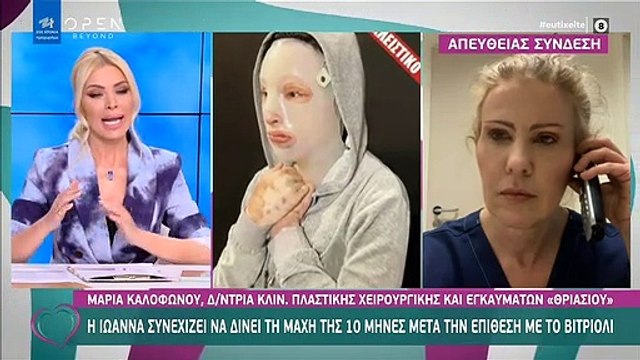 Επίθεση με βιτριόλι: Η Ιωάννα συνεχίζει να δίνει μάχη - Αυτός είναι ο λόγος που φορά τη μάσκα