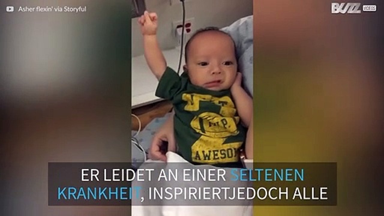 Nach drei Operationen spannt Baby mit seltener Krankheit Muskeln an