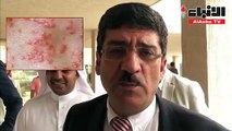 الصحة لم نسجل أي حالة غير طبيعية للجرب في الكويت