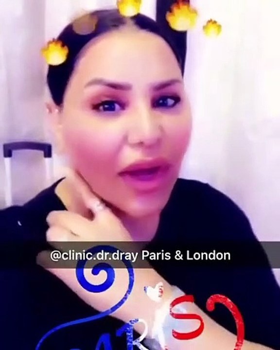 أحلام تخضع لعملية تجميل جديدة