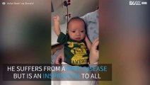 After three surgeries, baby with rare disease flexes his muscles