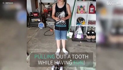 How to pull out a tooth like a champ!
