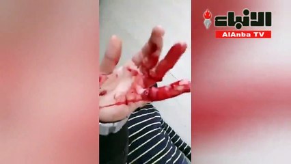 لاجي سوري