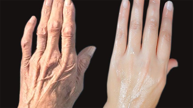 हाथों की झुर्रियां हो जाएगी दूर बस अपनाएं ये घरेलू तरीका ।Remove wrinkles of hands । Boldsky