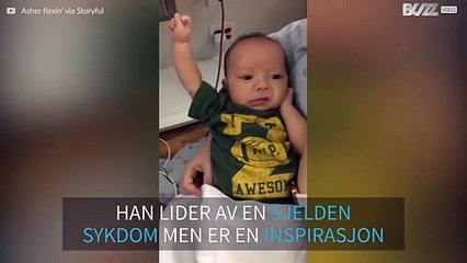 Etter tre operasjoner flekser en baby med en sjelden sykdom musklene sine