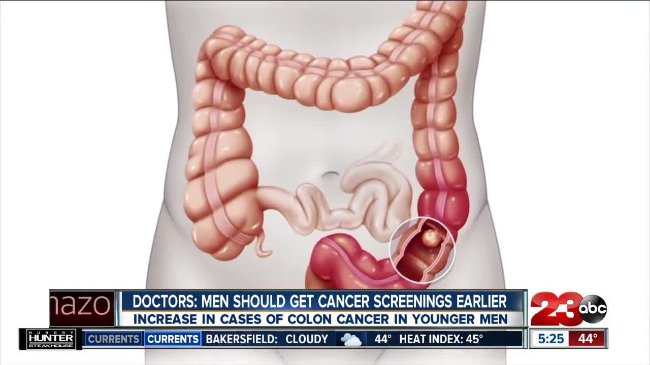Doctors say men should get cancer screenings ea...