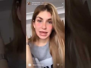 LA NOVIA DE FROILAN muestra el resultado de su CIRUGÍA ESTÉTICA