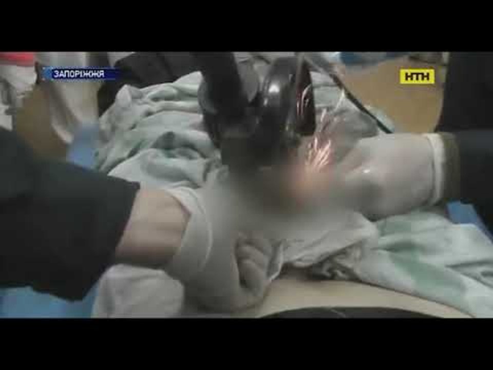 UNA MUJER PONE UNA TUERCA EN EL PENE DE SU ESPOSO POR UNA INFIDELIDAD