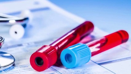 bd-anemia-enfermedad-o-sindrome-120321