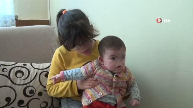 Doğuştan burunları ve solunum yolları olmayan küçük kız kardeşler uzanacak bir el bekliyor