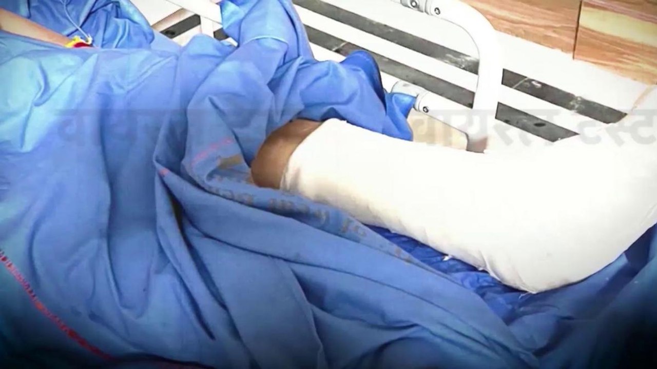 Fact Check: Old image shared as Mamata's injured leg
