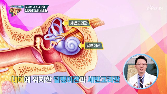균형을 못 잡고 어지럽다면!? ‘이석증’을 의심 하자! TV CHOSUN 20210314 방송