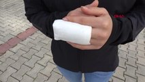 SAMSUN Parmakları ısırılan Acil Tıp Teknisyeni Büşranur: Ucuz atlattım, parmağımdan olabilirdim