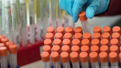 رواندا: طريقة جديدة لمسحة كورونا