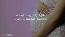 علاج البواسير بعد الولادة وتحاميل البواسير للمرضع