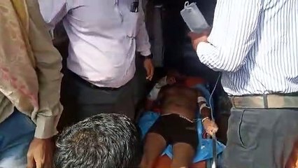 33 हजार केवी की लाइन की चपेट में आने से जिओ प्वाइंट मैनेजर बुरी तरह से झुलसा